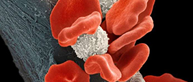 VIVO Healthcare Bloodborne Pathogens